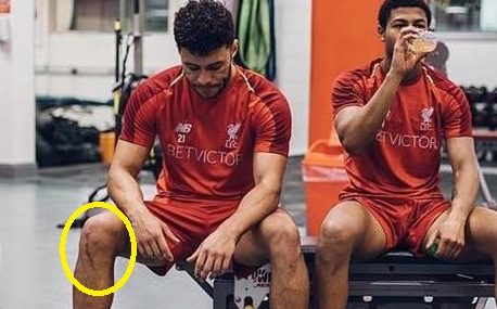 The gnarly scar on Ox’s leg shows what a massive recovery it has been from the Liverpool man