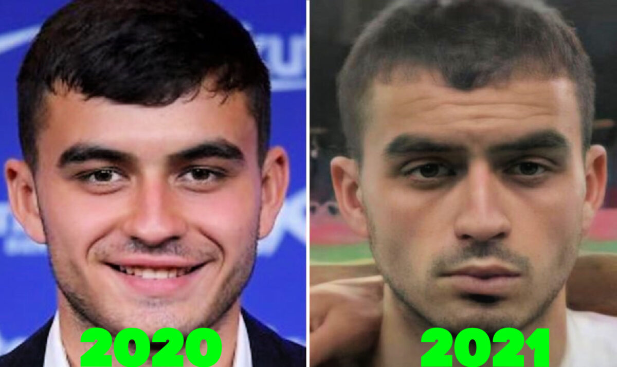 Pedri appears quite worse for wear when compared with a photo of him from 2020