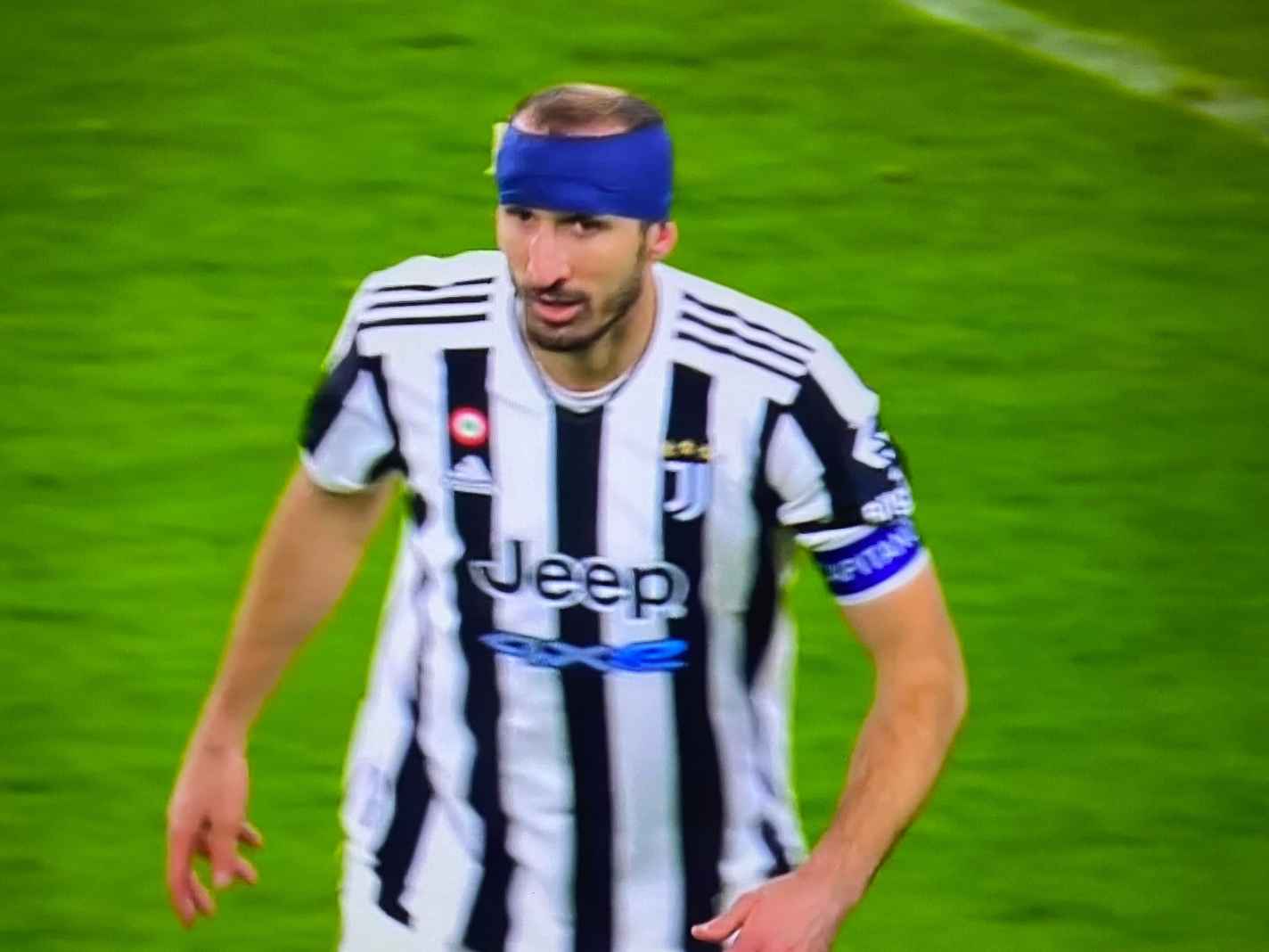 Giorgio Chiellini with a head bandage is football heritage