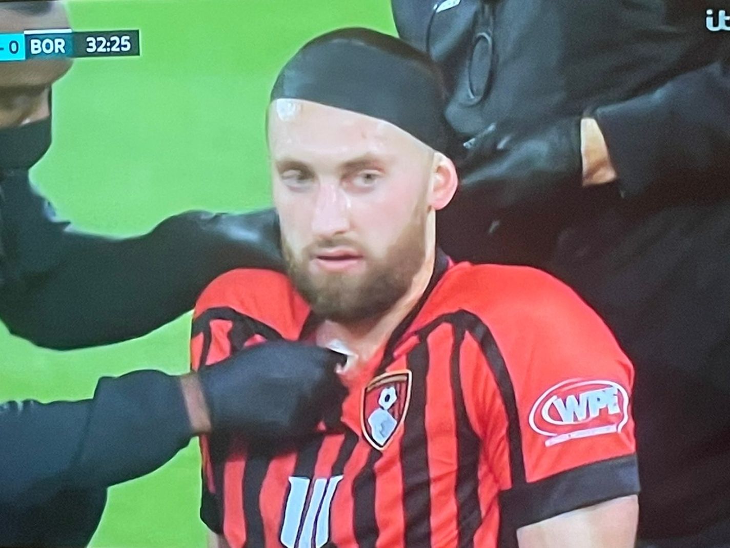 Twitter reacts as Nathaniel Phillips gets head bandaged 33 minutes into Bournemouth debut