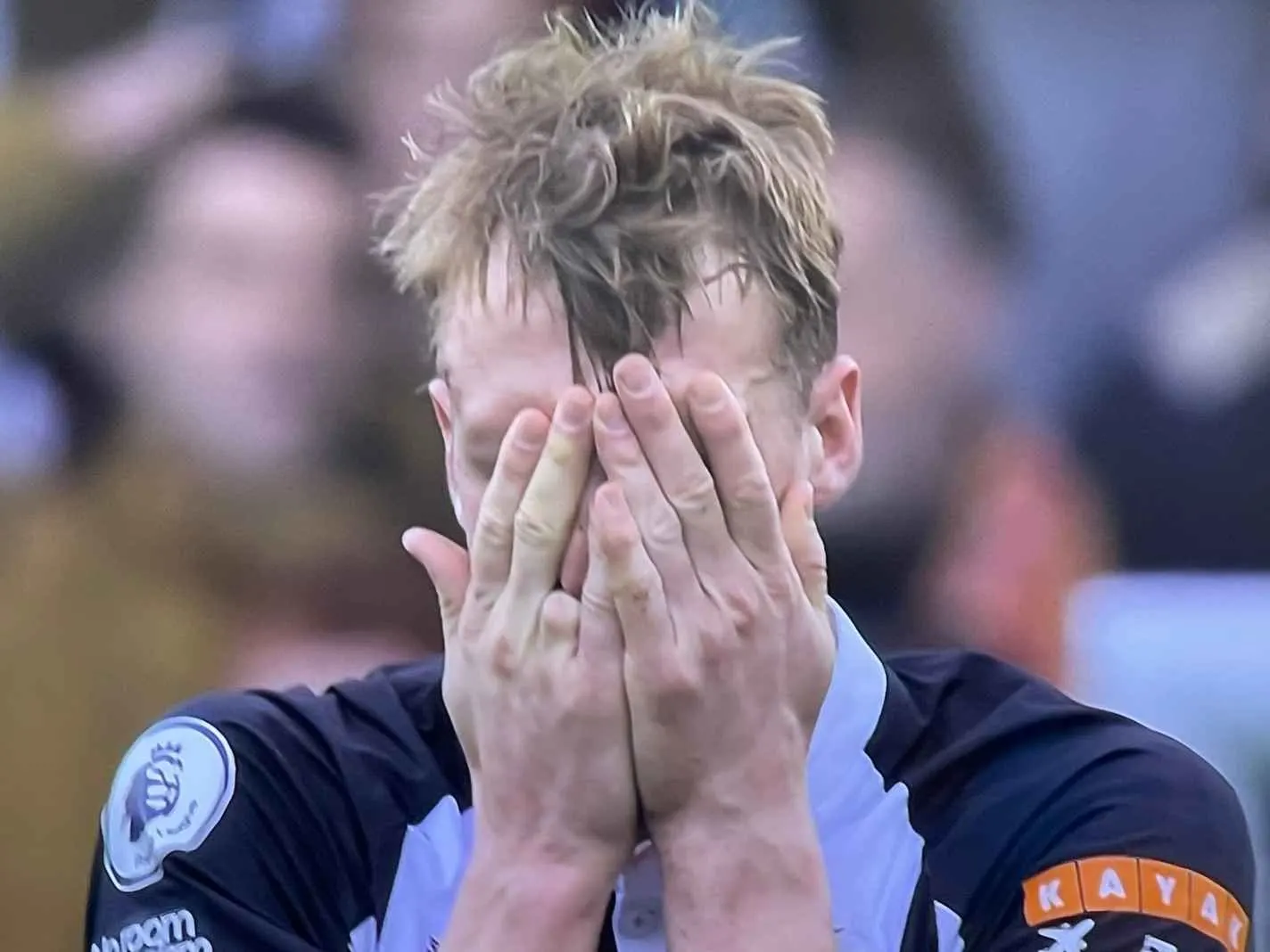Newcastle defender Dan Burn is missing a whole finger due to horrific accident when he was 13