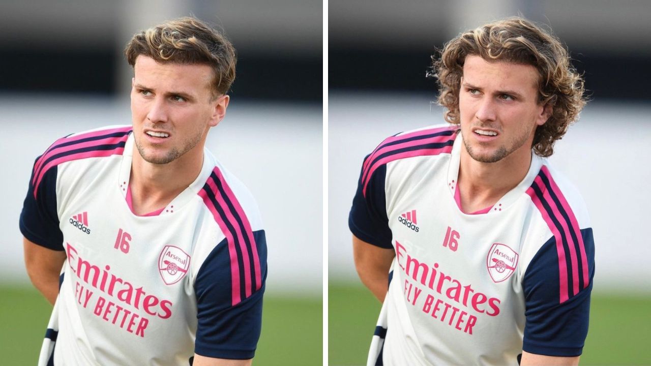 Rob Holding Shows Off Unreal Hairline Transformation – But There’s A Catch