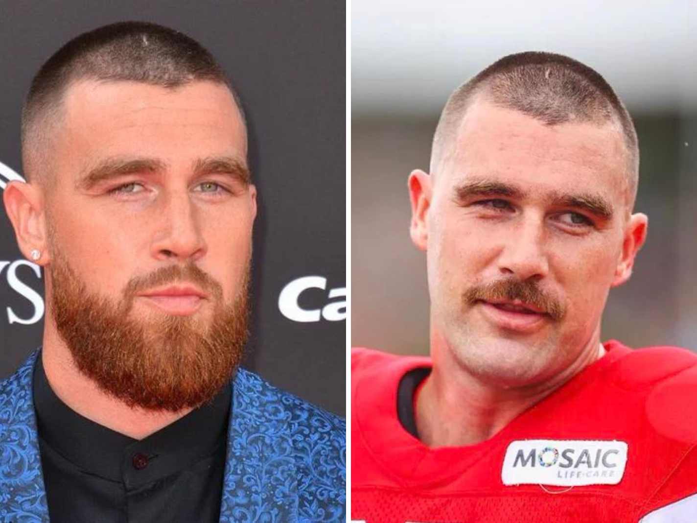 Fans in Disbelief as Travis Kelce Debuts Unsettling Mustache Makeover