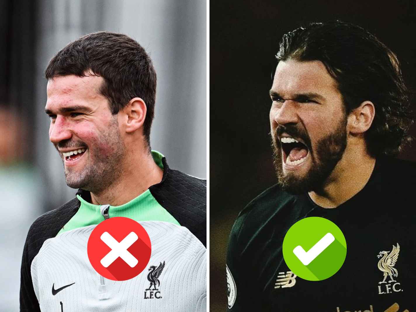 Alisson Divides Twitter With New Beardless Look: ‘Barber Needs to Have His License Revoked