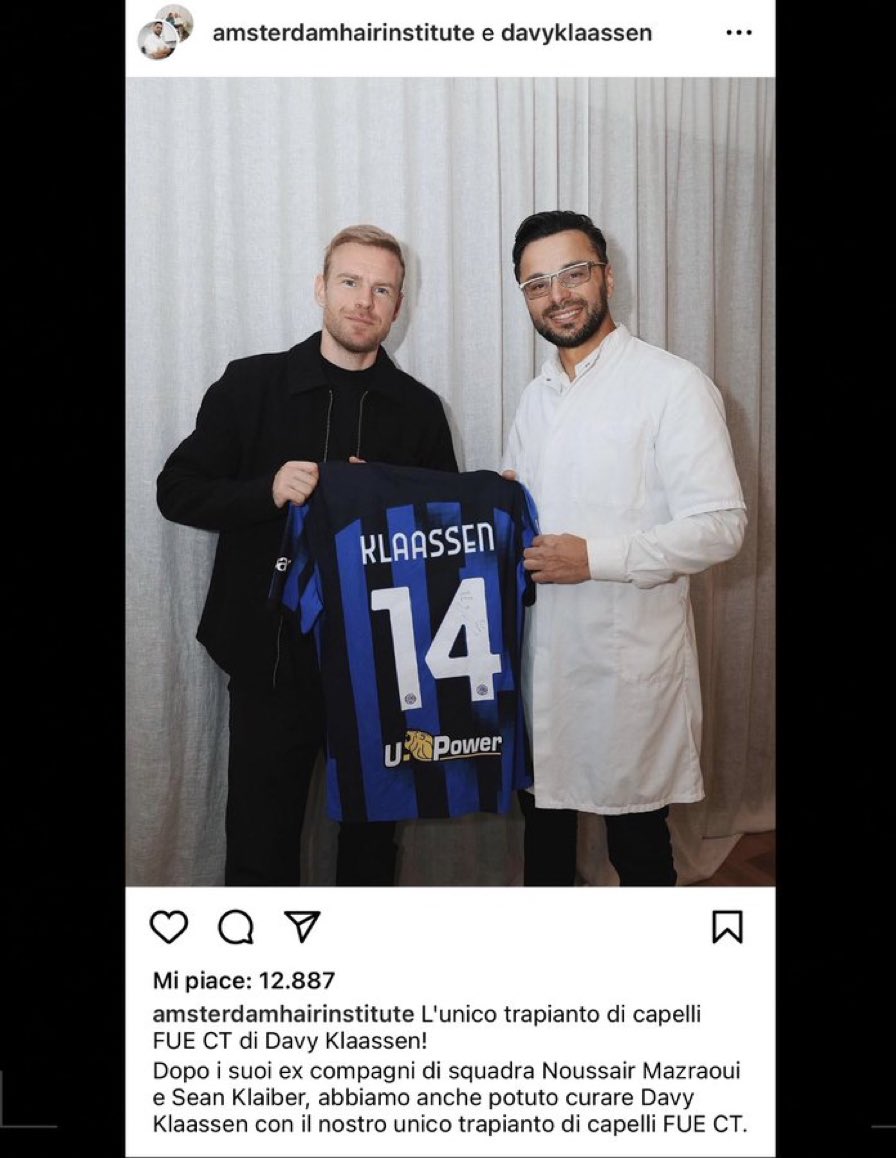 Davy Klaassen Becomes Football s Latest Hair Transplant Success Story davy-klaassen-becomes-football-s-latest-hair-transplant-success-story