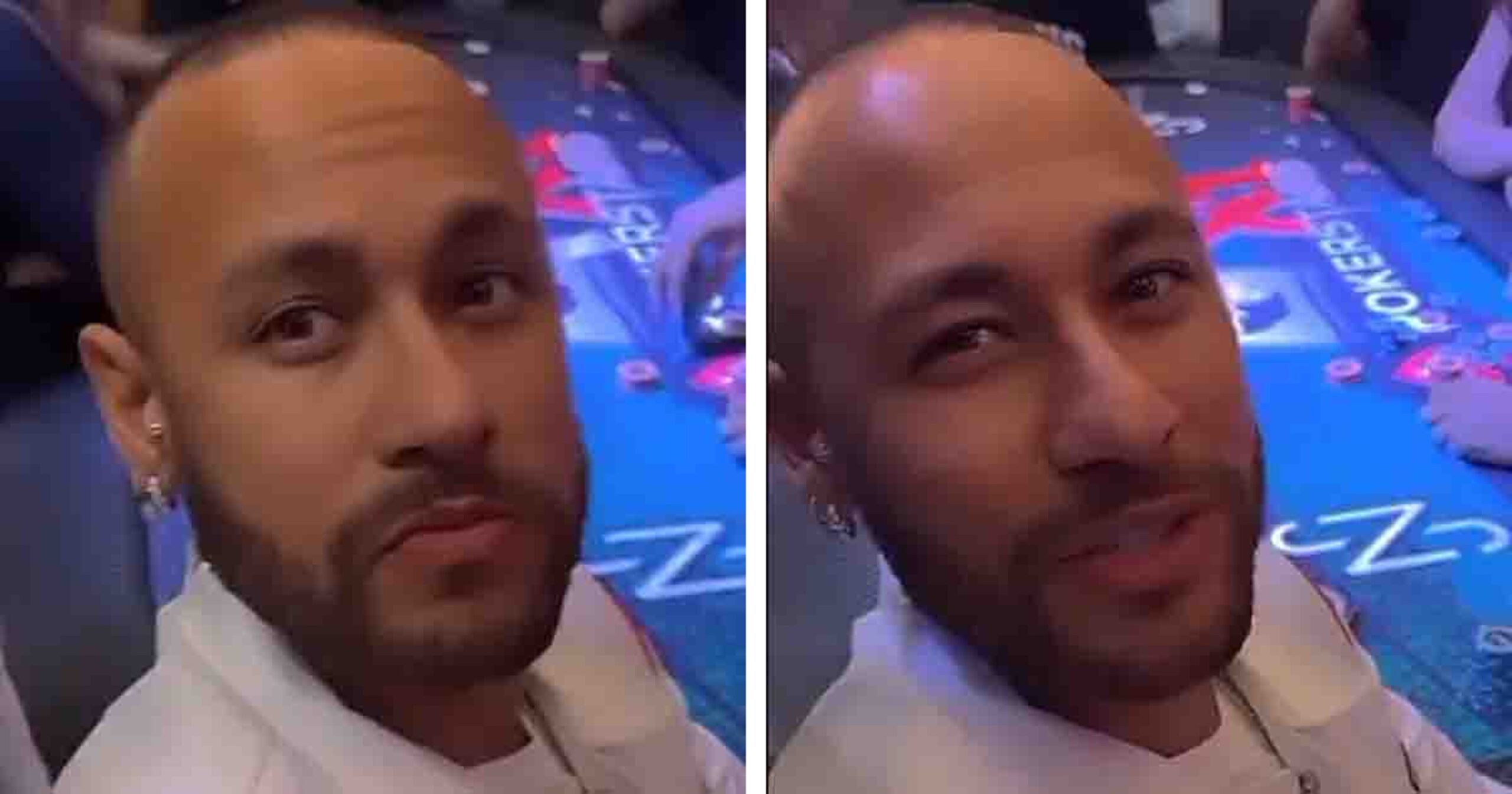 Is Neymar Really Losing His Hairline at 31? Fans Point Out Signs of Thinning