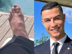 Fans Shocked by Cristiano Ronaldo’s Wartorn Feet in New Snap